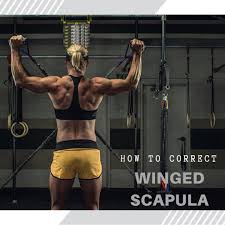 3 Snapping Scapula Syndrome Exercises