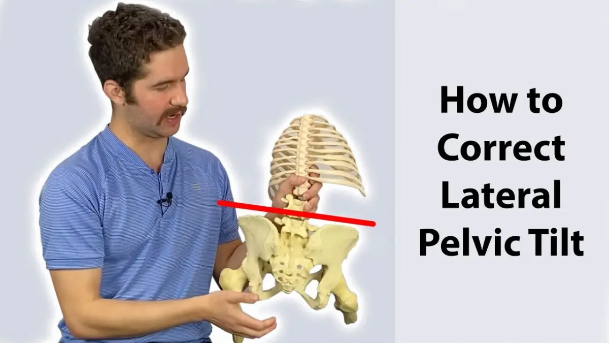 How to Prevent Lateral Pelvic Tilt
