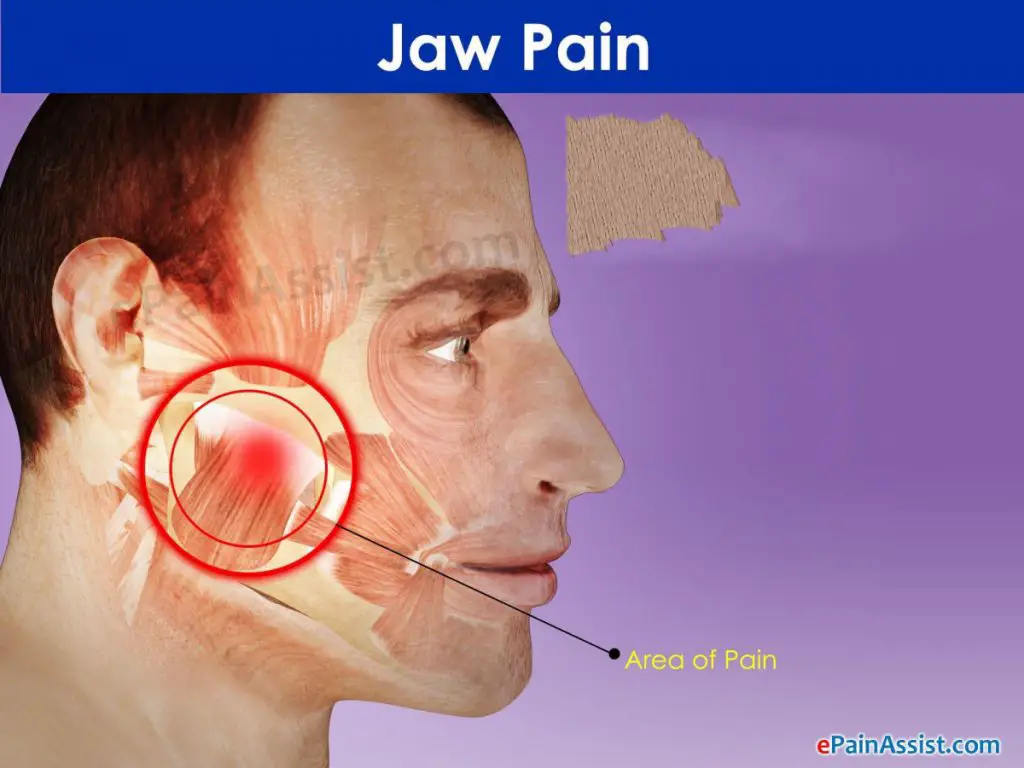 Can Wearing Headphones Cause Jaw Pain? PostureInfoHub