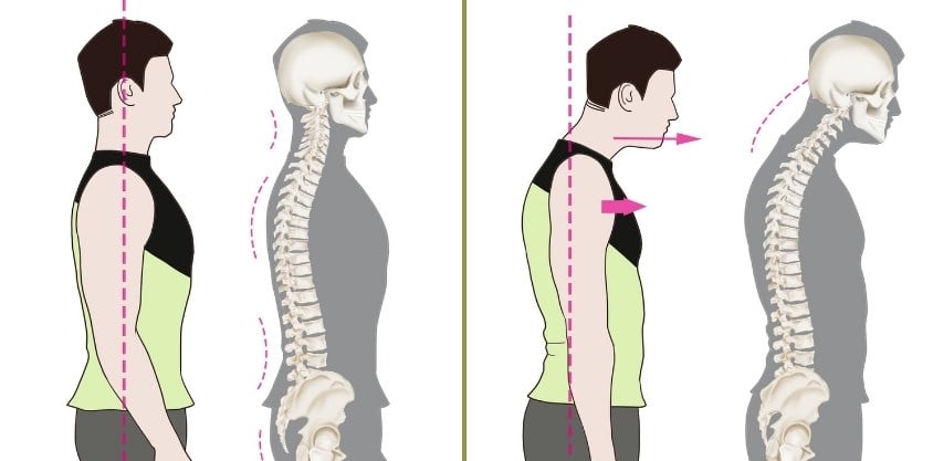 6 Posture Exercises For Forward Head