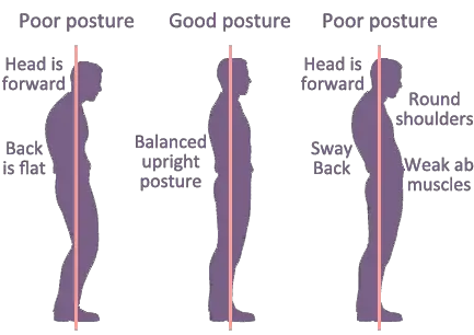 Can You Correct Years of Bad Posture